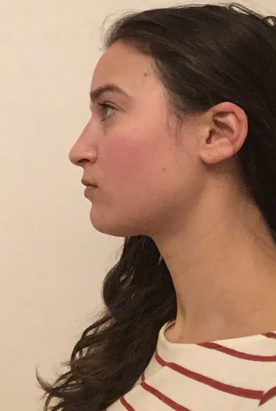 Filipína Cimrová
